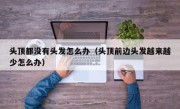 头顶都没有头发怎么办（头顶前边头发越来越少怎么办）