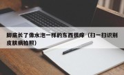 脚底长了像水泡一样的东西很痒（扫一扫识别皮肤病拍照）