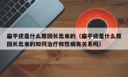 扁平疣是什么原因长出来的（扁平疣是什么原因长出来的如何治疗和性病有关系吗）