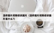 湿疹图片初期症状图片（湿疹图片初期症状图片是什么?）