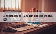 心电图导联位置（心电监护导联位置5导联连接）